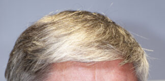 Ongarato defendió su gestión como intendente: “El contexto que tiene Taccetta es muy distinto al que me tocó a mí”