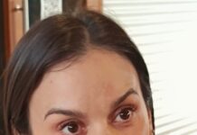 Hospital de Esquel: desde Salud afirmaron que la puesta en funcionamiento del tomógrafo es inminente